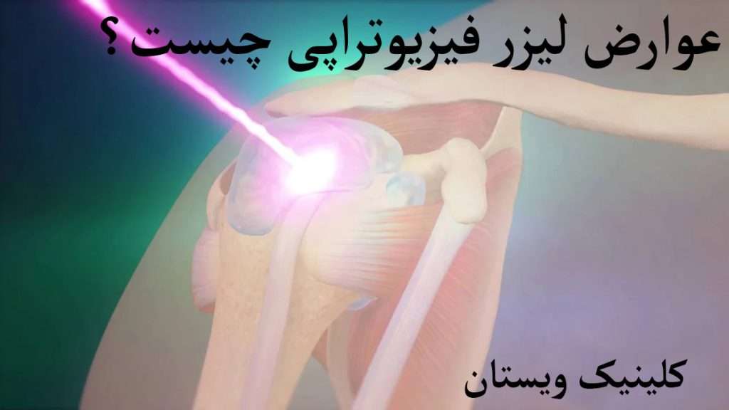 لیزر فیزیوتراپی تابیده شدن لیزر پرتوان بر مفصل نشان داده می شود