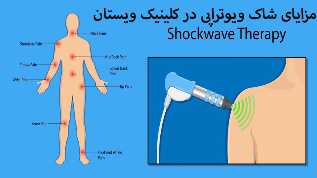 شاک ویو تراپی شاک ویوتراپی شانه نمایش داده می شود