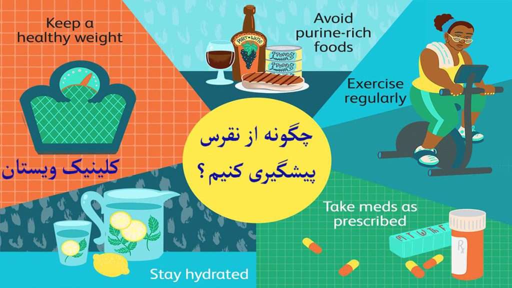 روش های پیشگیری از نقرس بیان شده است
