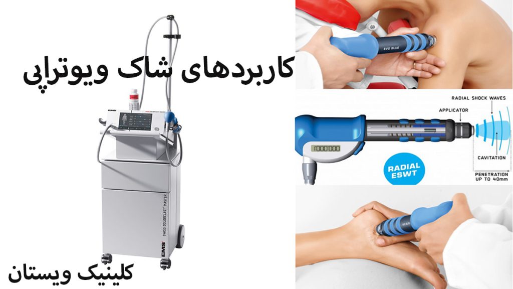 کاربردهای شاک ویوتراپی شاک ویو تراپی برای قسمتهای مختلف بدن انجام می شود