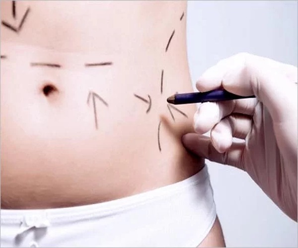 استفاده از نخ لاغری چربیسوز عوارض جانبی کمی دارد و ایمن است. نخ لاغری چربیسوز به راحتی و بدون نیاز به رژیمهای سخت قابل استفاده است.