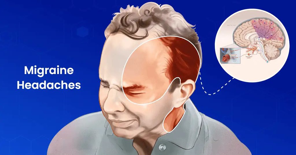 سردرد به طور کلی به عنوان "اولیه" یا "ثانویه" طبقه بندی می شود سردردهای تنشی شایع ترین هستند