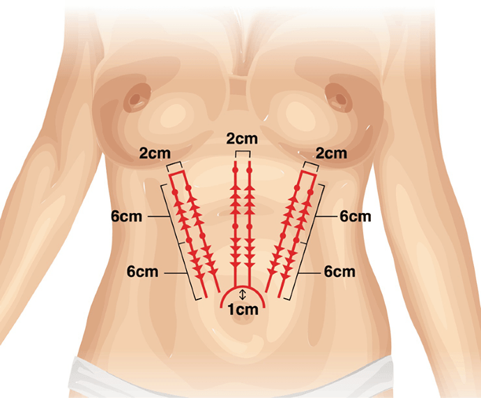 دکتر شهربانو کاظمی دارای سالها تجربه در زمینه طب سوزنی و کاهش وزن است. دکتر شهربانو کاظمی با دقت و حرفهای بودن خود در این زمینه شناخته شده است.