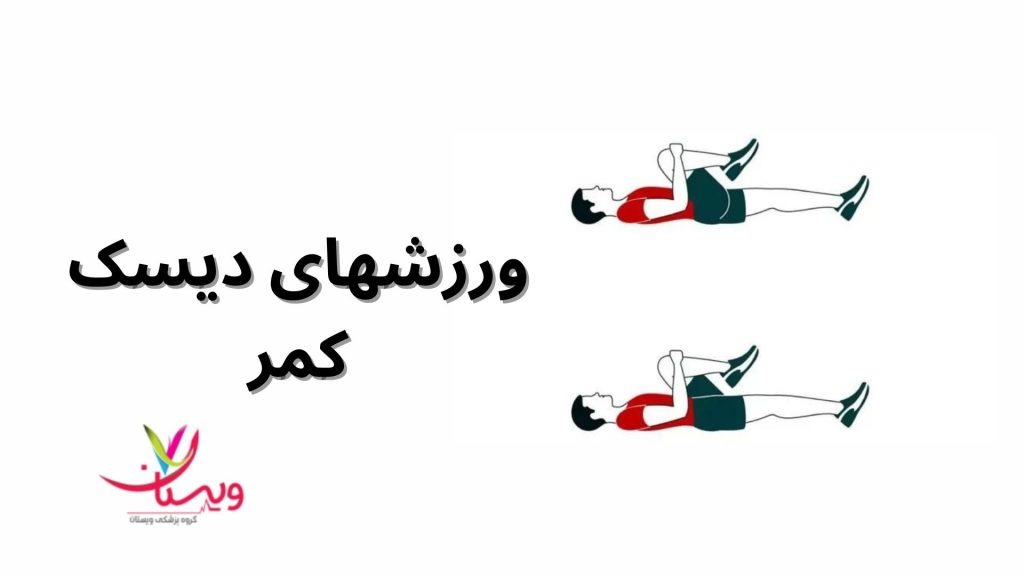 ورزشهای دیسک کمر