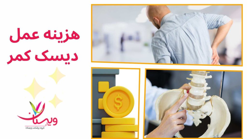هزینه عمل دیسک کمر