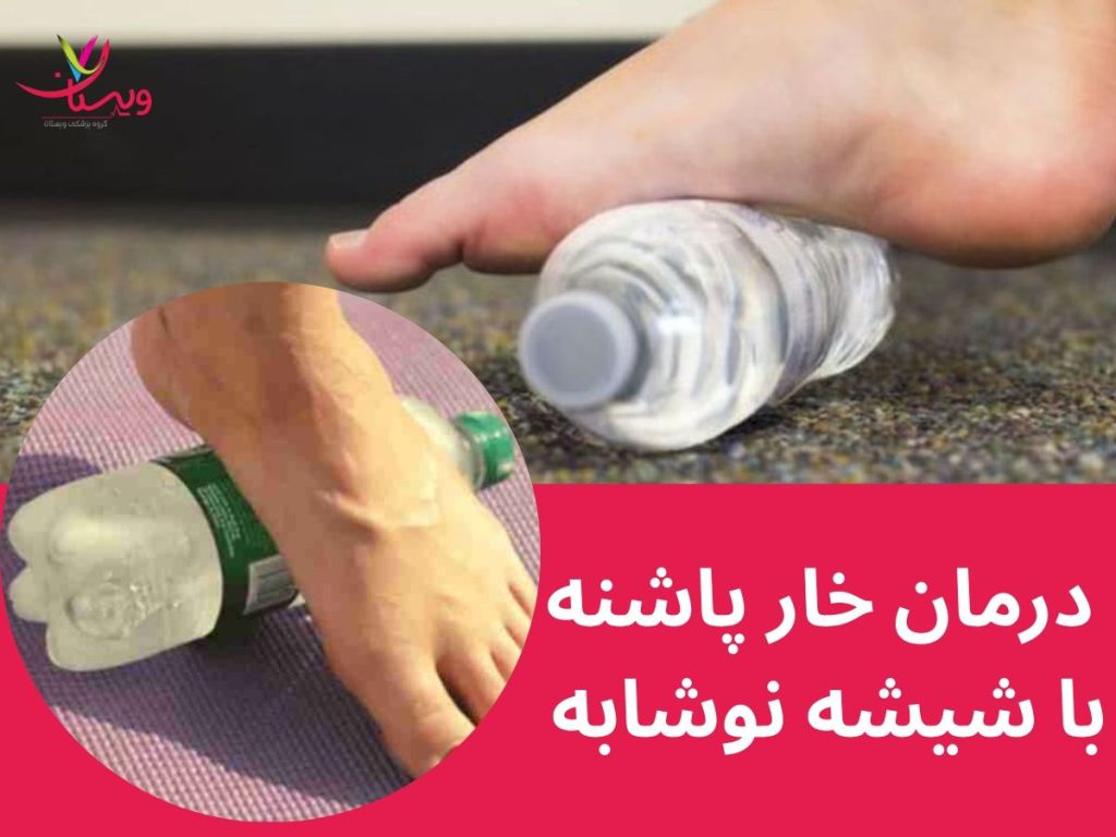 درمان خار پاشنه با شیشه نوشابه
