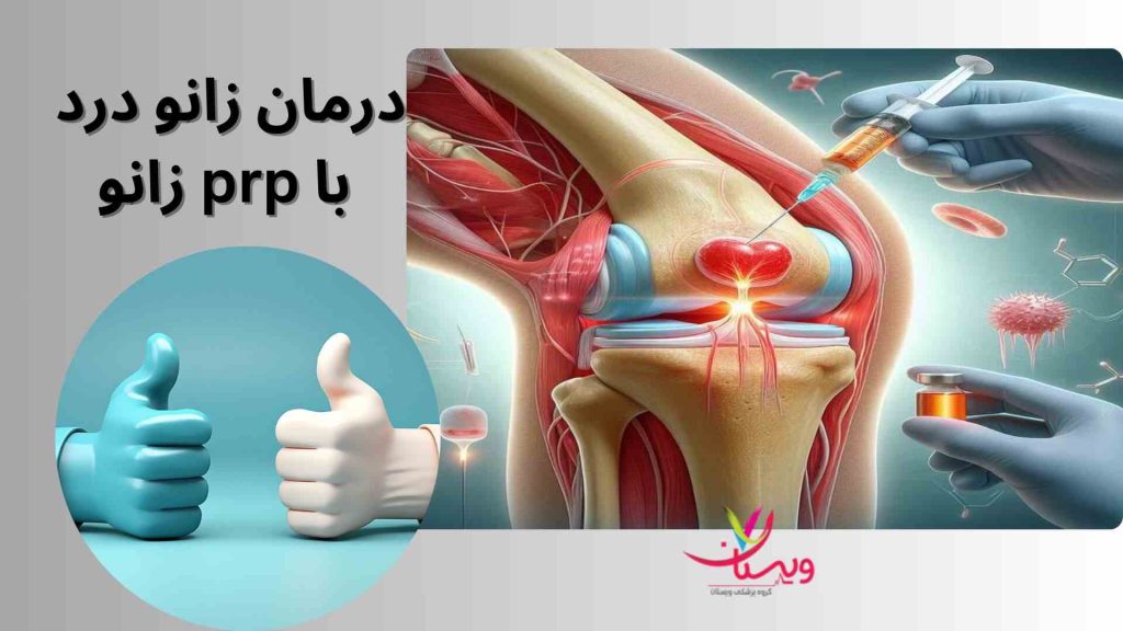 مفصل زانو بهبود عملکرد مفصل زانو