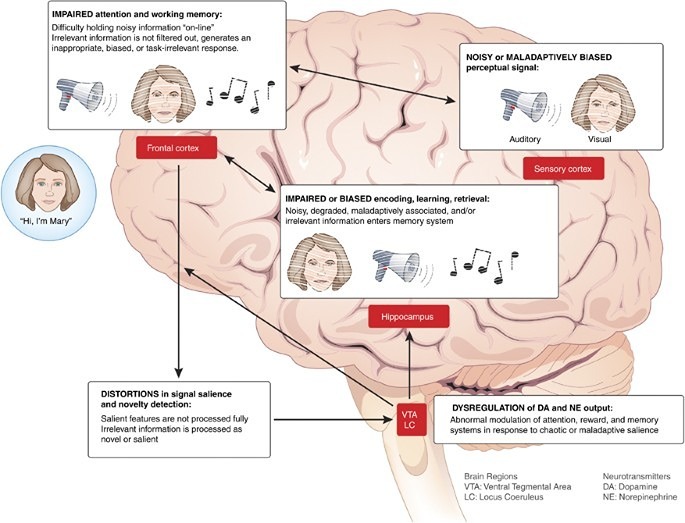 آمینزیای پیشرونده (Anterograde Amnesia): فرد توانایی یادگیری و به خاطر سپردن اطلاعات جدید را از دست میدهد. اختلال حافظه یا آمینزیا (Amnesia) به از دست دادن توانایی به یاد آوردن اطلاعات قبلی یا یادگیری اطلاعات جدید گفته میشود.