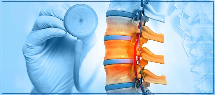 خستگی ام اس ام اس از شکست سیستم ایمنی بدن در از بین بردن سلولهای T و سلولهای B خودواکنشی ناشی میشود