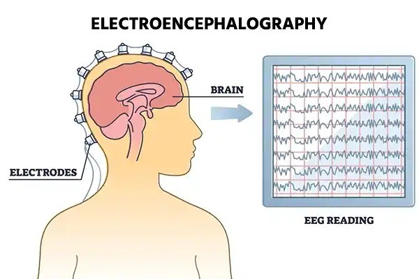 EEG برای تشخیص اختلالات مغزی استفاده میشود. اندازه گیری های پیشرفته تر سیگنال های غیر طبیعی EEG نیز اخیراً به عنوان نشانگرهای زیستی ممکن برای اختلالات مختلف مانند بیماری آلزایمر مورد توجه قرار گرفته است.