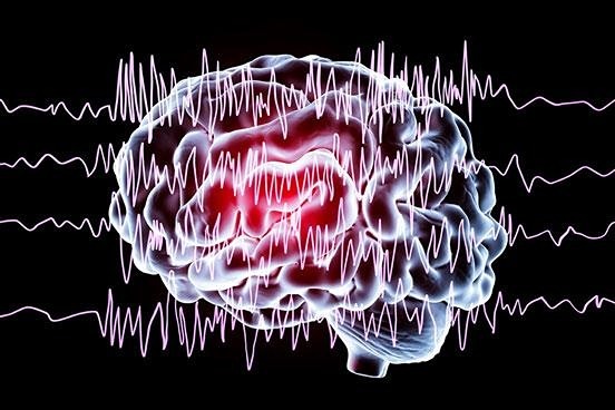 EEG بی خطر است و منع مصرف قابل توجهی ندارد. این آزمایش را مانیتورینگ EEG، EEG تله متری یا نظارت تصویری EEG نیز می نامند.