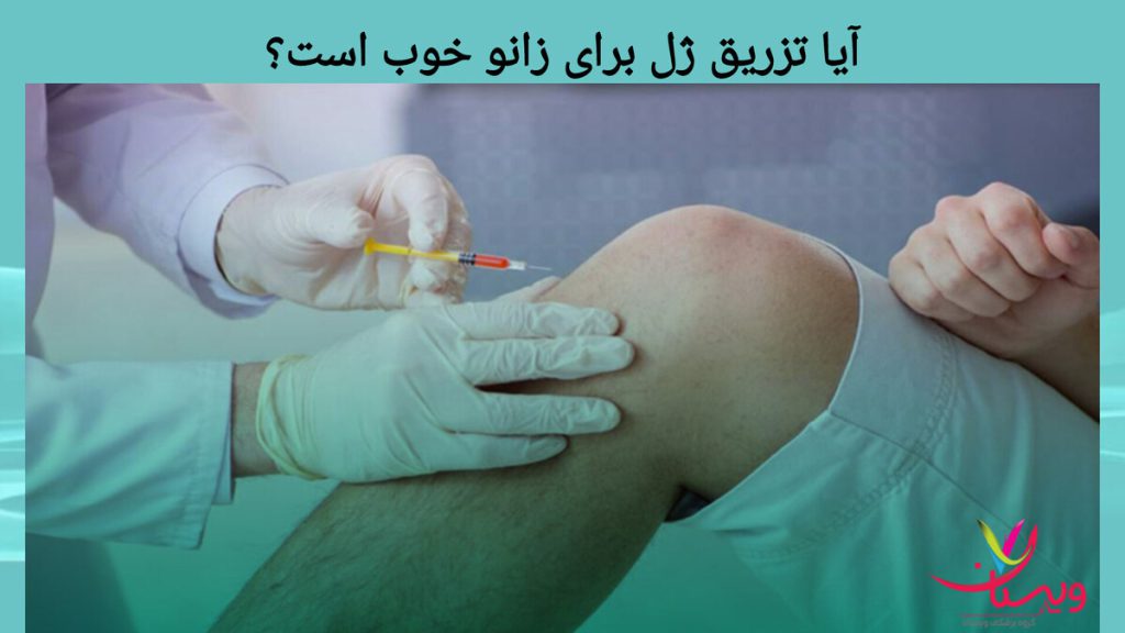 تزریق ژل، راهکاری درمانی بدون جراحی آیا تزریق ژل برای زانو خوب است؟