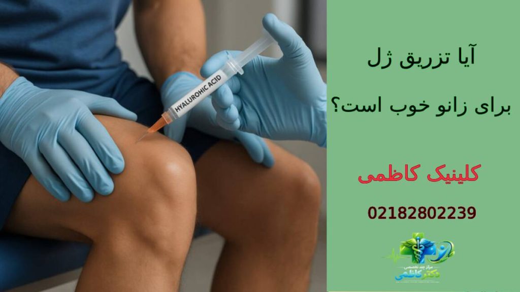 آیا تزریق ژل برای زانو خوب است؟
