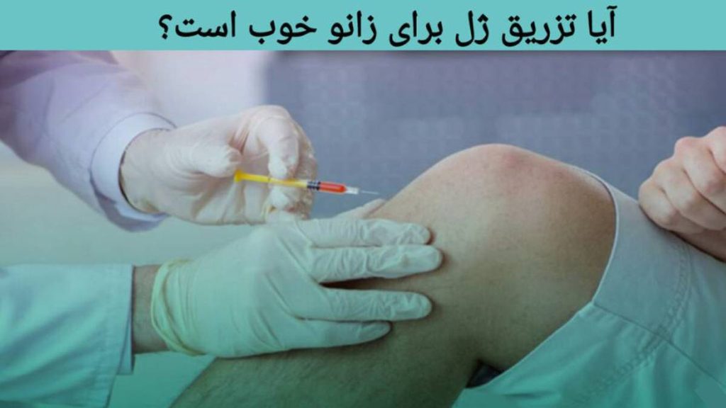 آیا تزریق ژل برای زانو خوب است؟