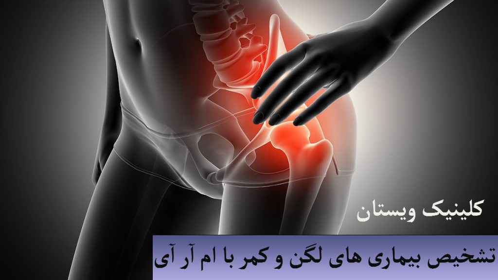تشخیص بیماری با ام ار ای تصویری دیجیتالی از استخوان کمر و لگن فرد