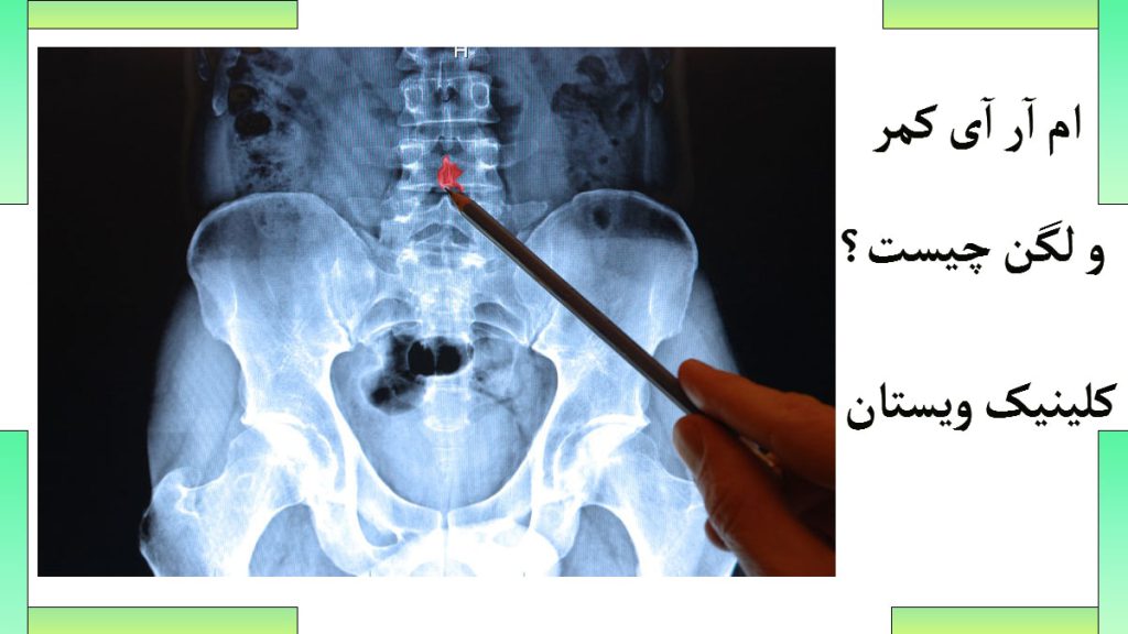 تصویر ام آر آی کمر و لگن و پزشکی به ان اشاره می کند