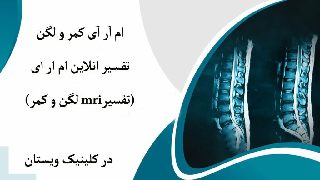 ام آر آی ستون فقرات نشان داده می شود