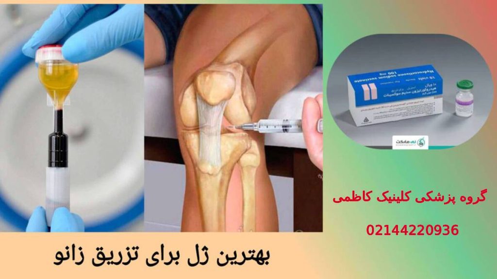 بهترین ژلهای تزریق زانو