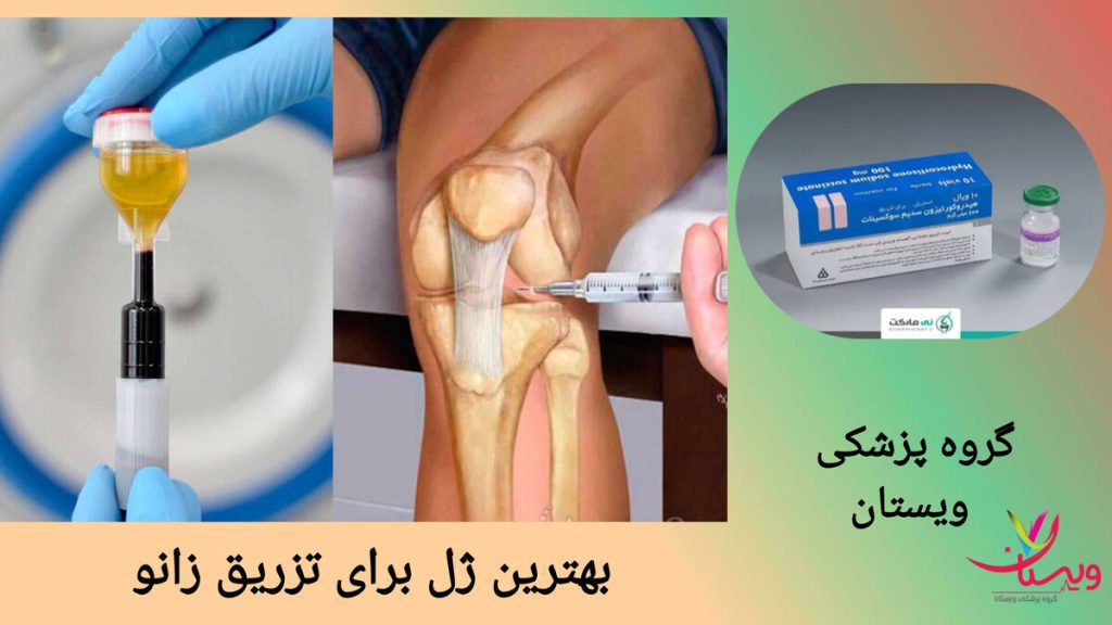 معرفی بهترین ژل زانو برای تزریق نمایی از بهترین ژل زانو و تزریق ژل توسط پزشک