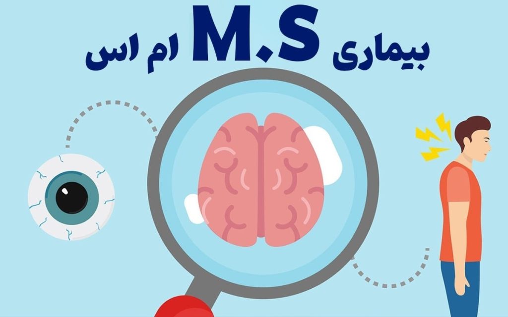 تاثیر ام اس بر بینایی تاثیر ام اس بر بینایی