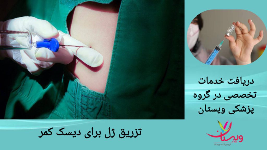 تزریق ژل برای دیسک کمر راهکاری غیر جراحی جهت درمان درد بیمار انجام تزریق ژل در ناحیه کمر، برای درمان بیرون زدگی دیسک