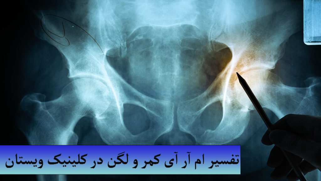 تفسیر ام آر آی یک عکس ام آر آی از لگن