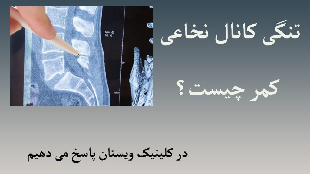 تنگی کانال نخاعی کمر تصویری رادیولوژی از ستون فقرات