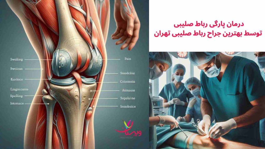 رباط صلیبی بالا بردن زانو