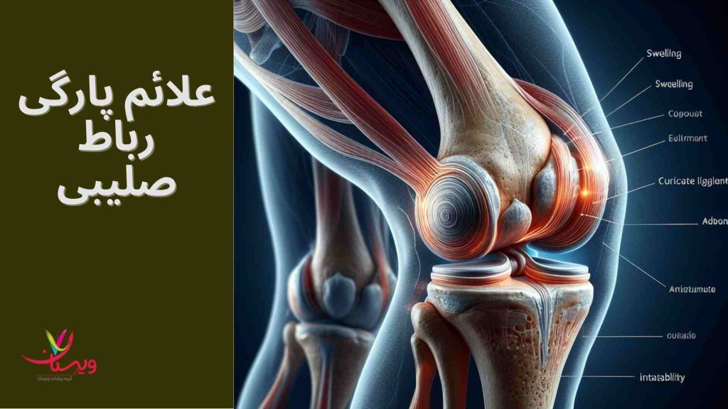 تشخیص دقیق پارگی رباط متخصص فیزیوتراپی