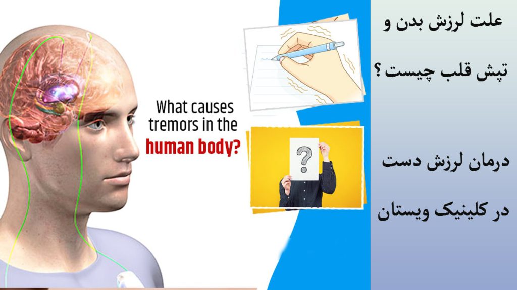 یک شخص در سمت چپ که مغز او به طور مشخص نشان داده شده است