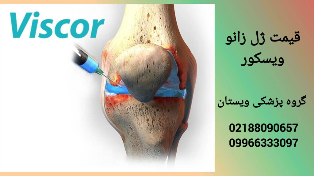 قیمت ژل ویسکول در مراکز معتبر نمایی از یک سرنگ ژل ویسکور و قیمت آن