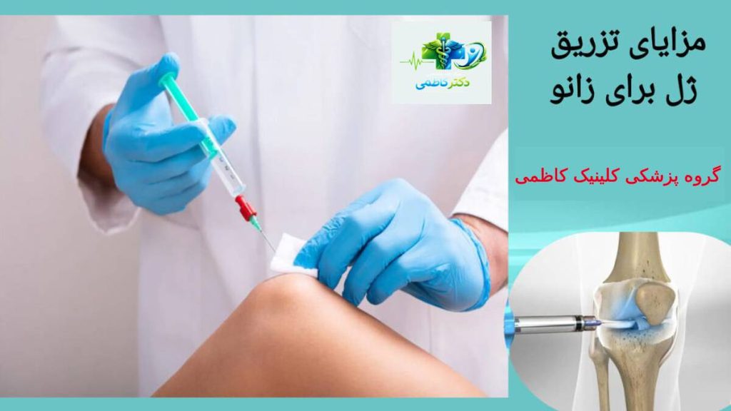 مزایای تزریق ژل برای زانو