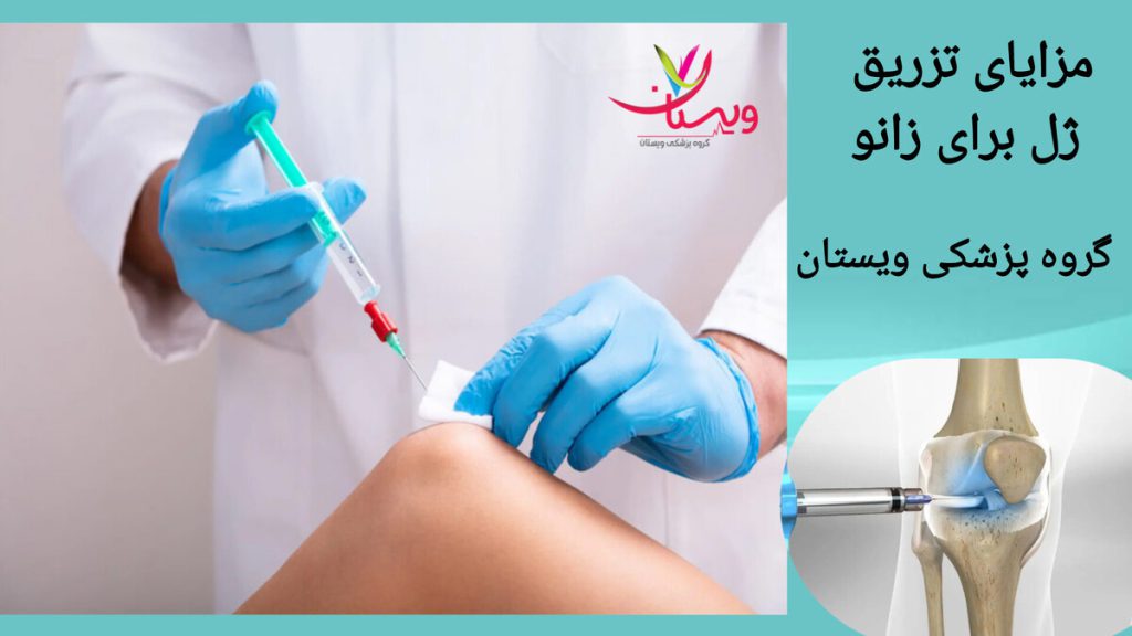 تزریق ژل راهکاری موثر برای تسکین دردهای مفصل زانو فردی در حال دریافت تزریق ژل در مفصل زانو برای تسکین درد