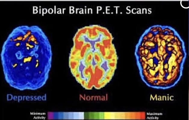 تکنیکی پرکاربرد در تشخیص و درمان است. نوار مغز