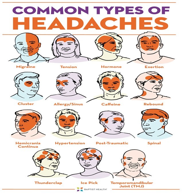 تنش عضلانی باعث سردرد می شود؟ آیا سردرد شما ناشی از تنش عضلانی است؟