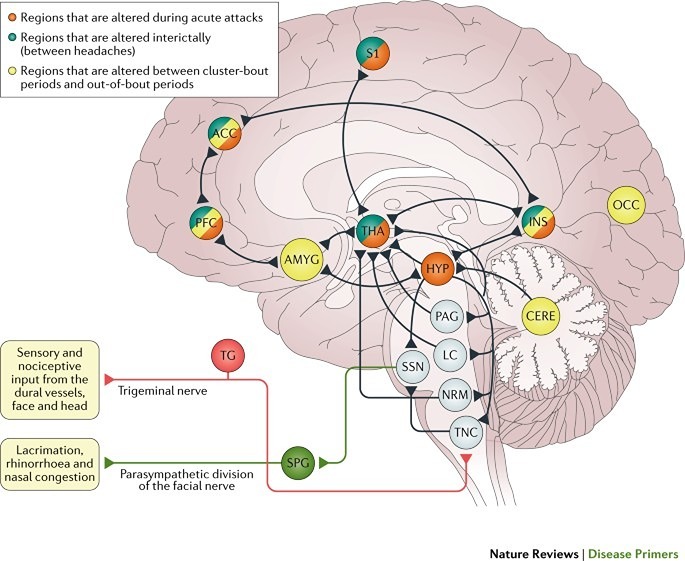 درمان سردردهای تنشی