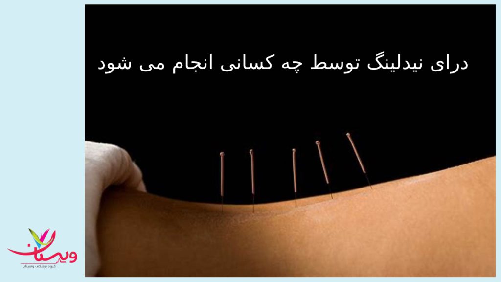 نحوه انجام درای نیدلینگ توسط متخصص طب سوزنی سوزن خشک در کمر بیمار فرو رفته است برای درد کمر