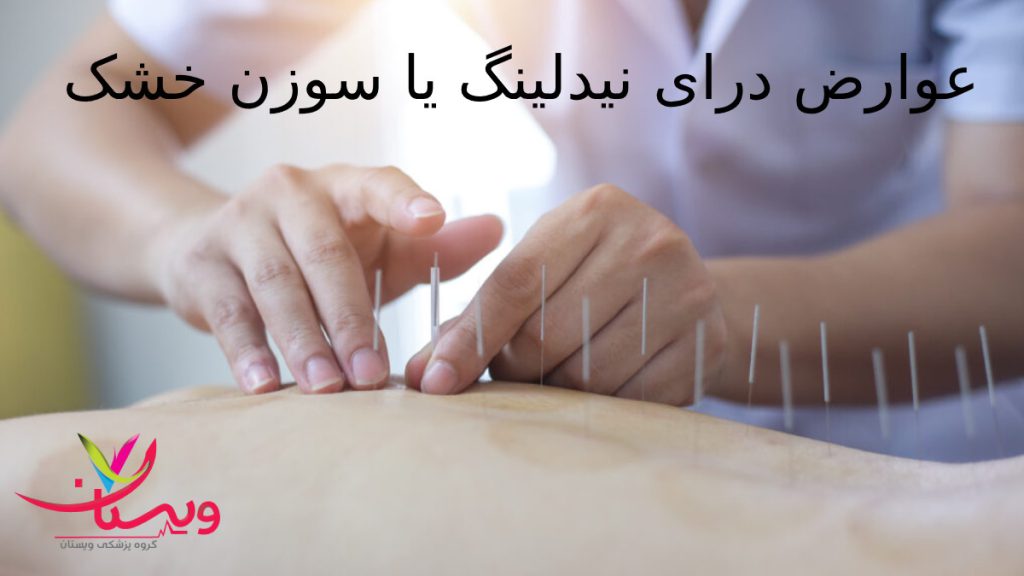 عوارض شایع سوزن خشک درمانگر طب سوزنی در حال اجرای سوزن خشک روی کمر بیمار