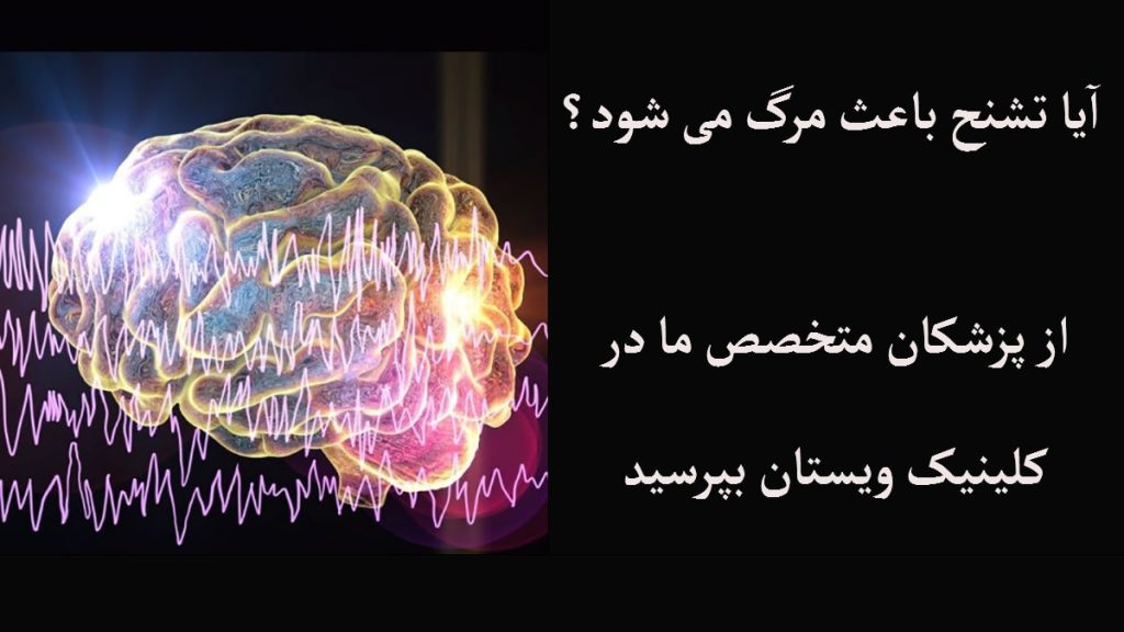 ارتباط تشنج و مرگ پس زمینه مشکی با تصویری دیجیتالی از مغز