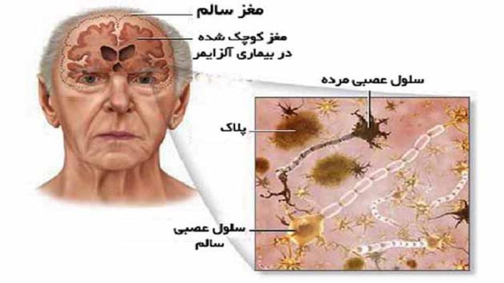 نشانههای بیقراری دلایل بیقراری