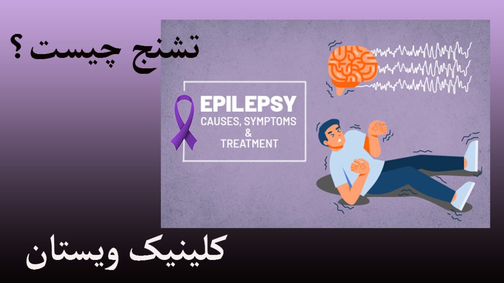 تشنج چیست یک شخص که روی زمین افتاده و دچار تشنج شده است-یک نوشته با عنوان تشنج چیست؟