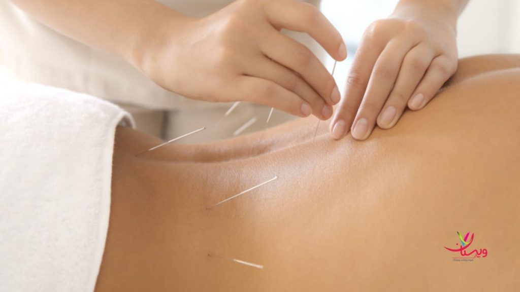 طب سنتی برای درمان دیسک کمر هزینه هر جلسه طب سوزنی چقدر میباشد