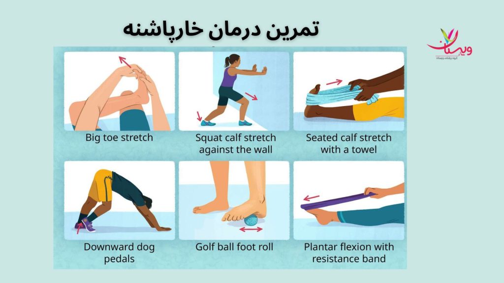 درمان خانگی خارپاشنه درمان خار پاشنه پا بدون جراحی