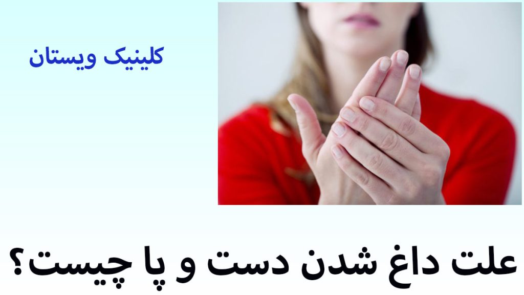 علت داغ شدن دست و پا یک خانم که دچار داغ شدن کف پا شده است