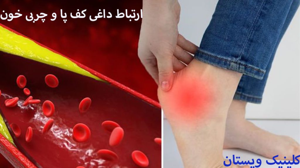 گلبول های قرمز خون و سوزش کف پای یک شخص نشان داده شده است