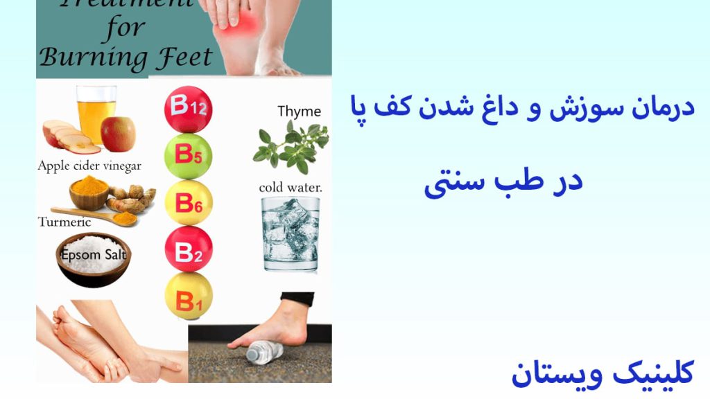 طب سنتی و درمان سوزش کف پا چند داروی گیاهی و پای انسان که سوزش کف آن با رنگ قرمز نشان داده شده است