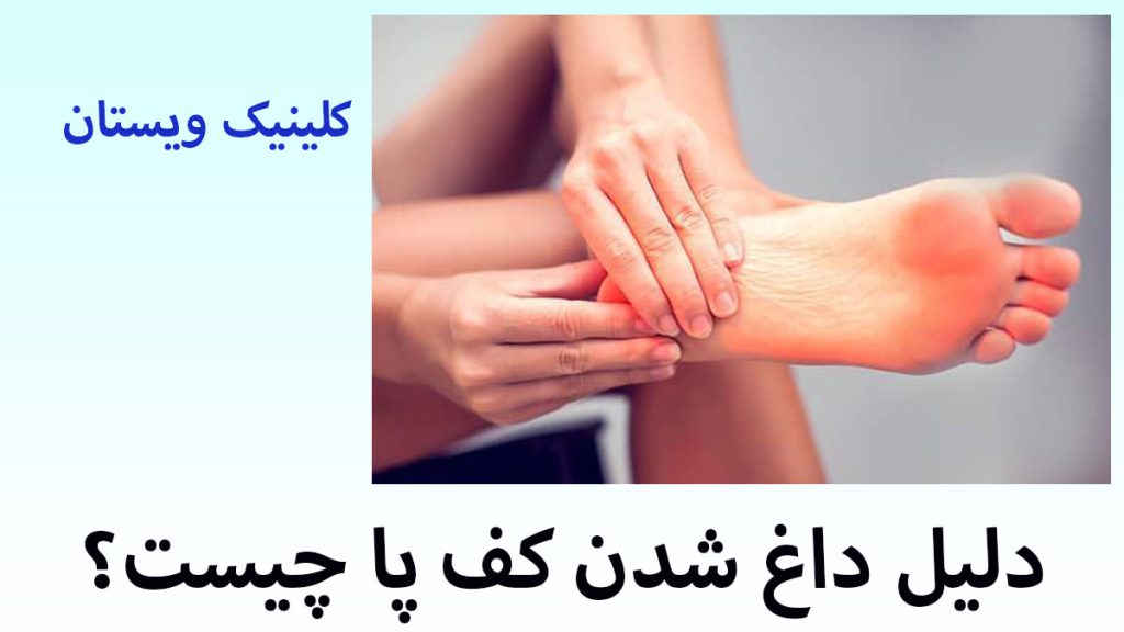 دلیل داغ شدن کف پا کف پای یک شخص دارای سوزش و داغی است