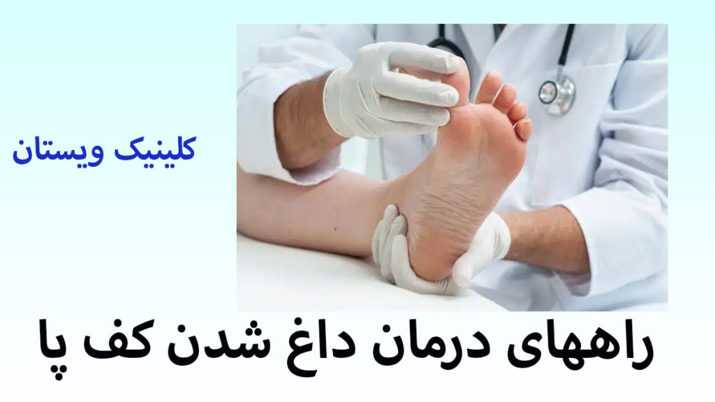درمان داغ شدن کف پا یک پزشک در حال درمان پای بیمار