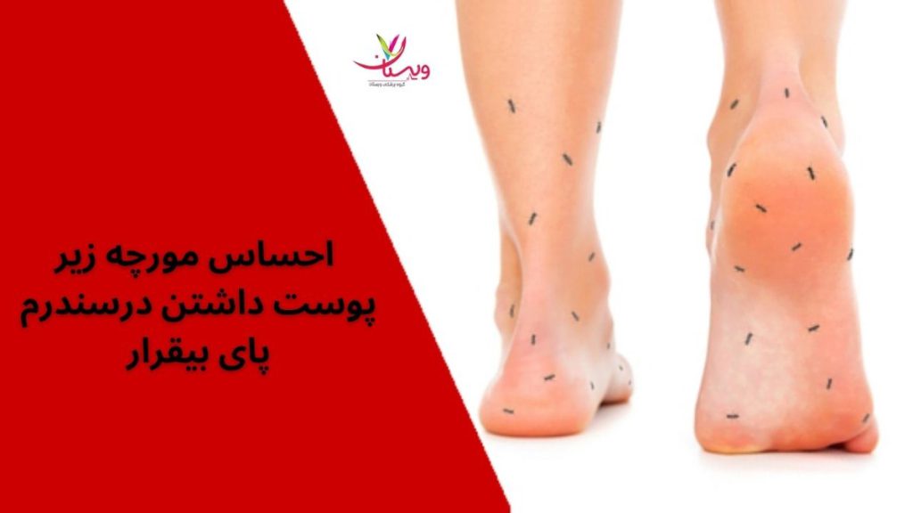 سندروم پای بیقرار سندروم پای بیقرار