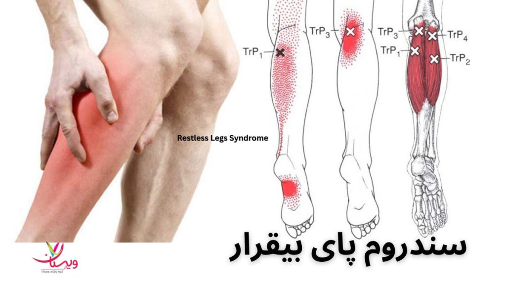 سندروم پای بیقرار